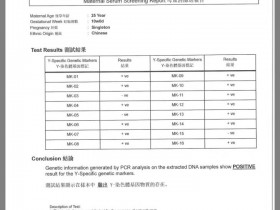 香港验血化验单怎么看？