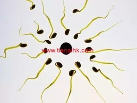 B超监测排卵从什么时候做比较好?