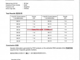 香港验血结果以及报告单