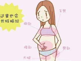 孕期到多少个月才会有妊娠纹?