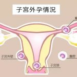 香港验血要怀孕多久才可以查？