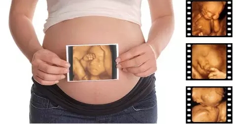 怀孕达到7周去香港做胎儿性别鉴定准吗？