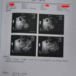 惊！登入官网就能预约去香港验血查胎儿性别？
