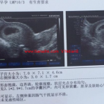 怀孕55天去香港验血行吗